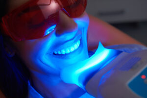 Teeth Whitening: Professional vs. At-Home Options