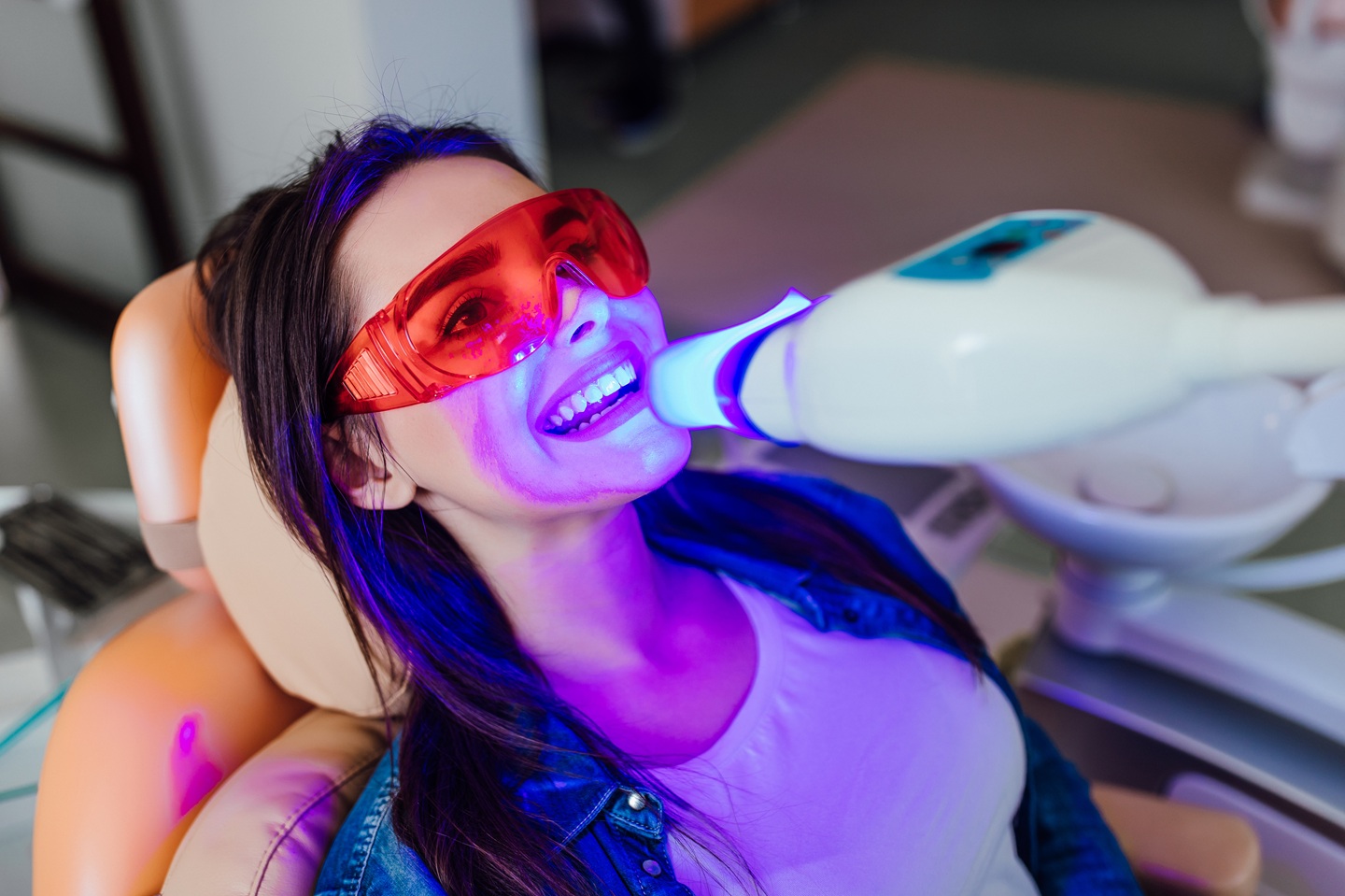 Teeth Whitening Butterfly-Dental-Care-Dentist-San-Jose-CA