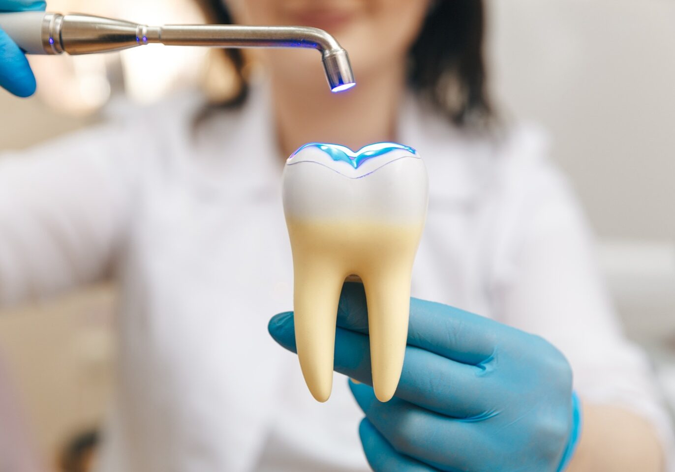 Dental Fillingss Butterfly Dental Care Dentist San Jose CA
