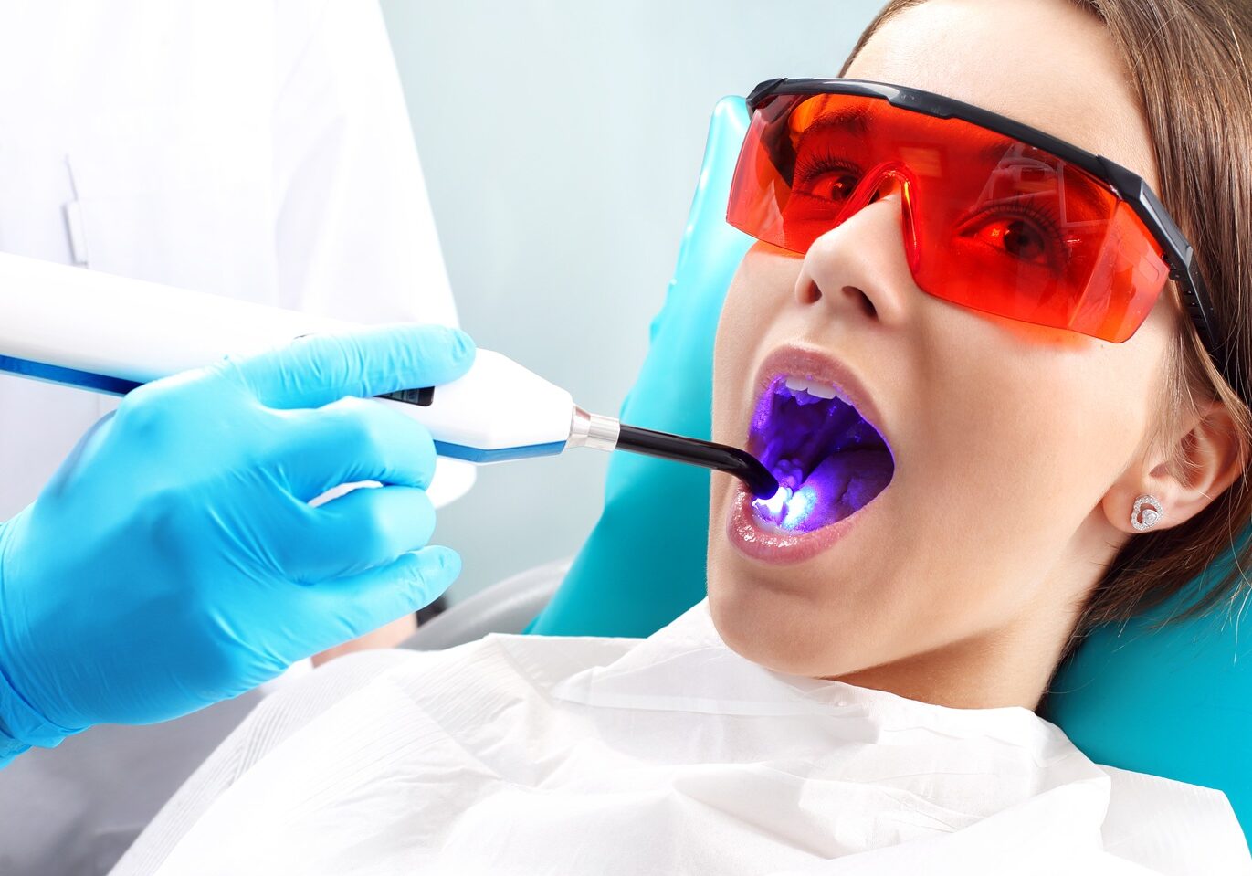 Fotona Laser Dentistry-Butterfly-Dental-Care-San-Jose-CA