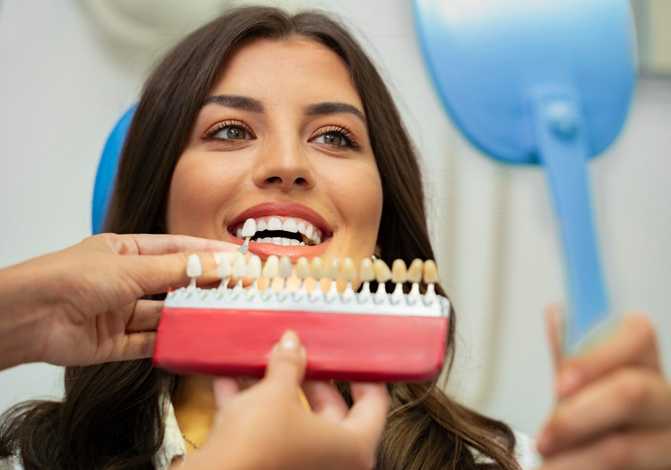 Porcelain Veneers Butterfly-Dental-Care-San-Jose-CA